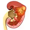 kidney