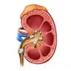 kidney