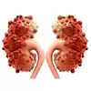 kidney