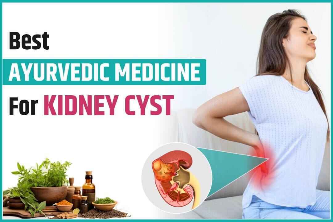 Best Ayurvedic Medicine For Kidney Cyst
