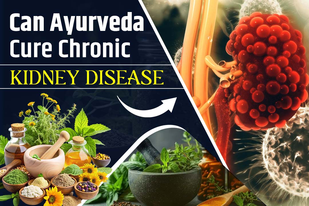 Can Ayurveda Cure Chronic Kidney Disease? Here’s the Truth