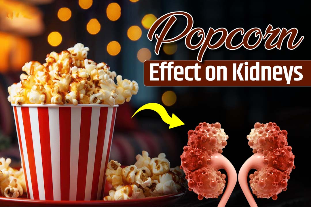 Is popcorn silently harming your kidneys? Hidden Dangers Explained 