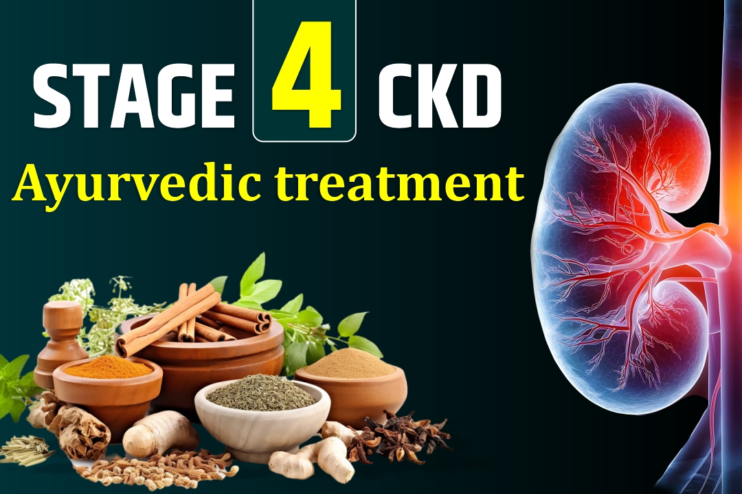 Stage 4 CKD Ayurvedic Treatment