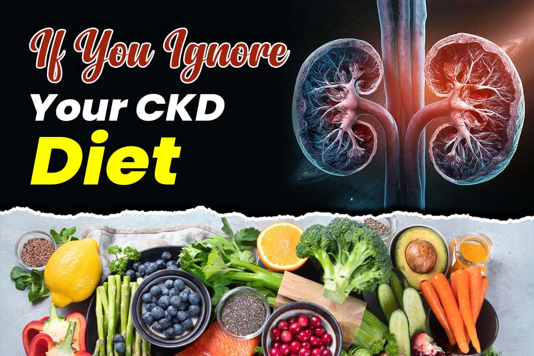 What Happens If You Ignore Your CKD Diet?