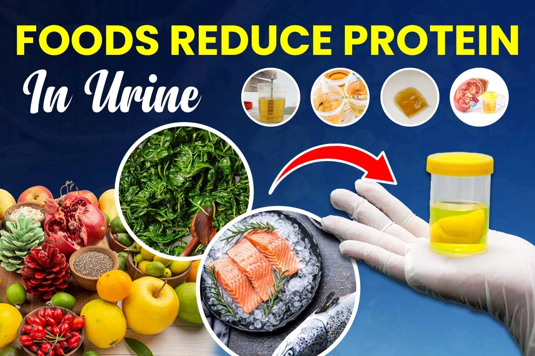 What Foods Reduce Protein in Urine? A Useful Guide