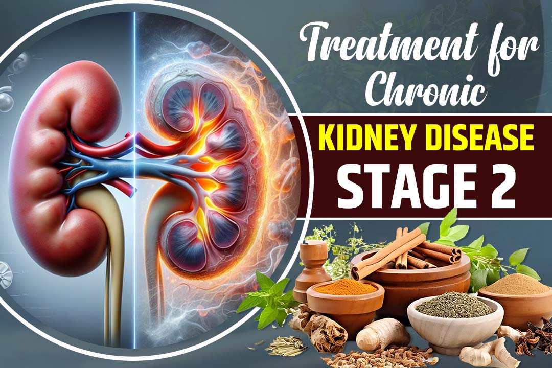  Best Treatment for Chronic Kidney Disease Stage 2