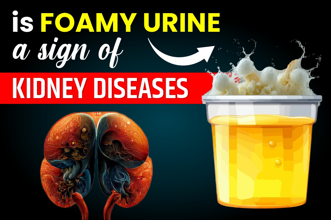 Is Foamy Urine a Sign of Kidney Diseases
