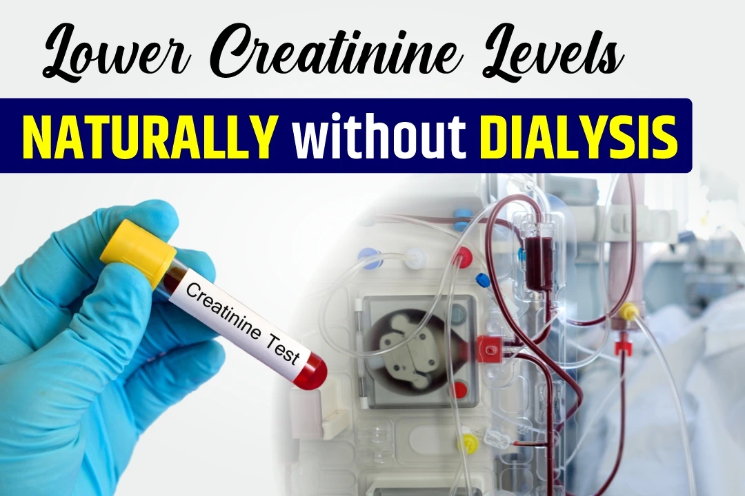 How to Lower Creatinine Levels Naturally without Dialysis?