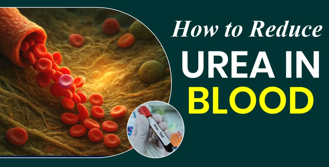 How to Reduce Urea in Blood?